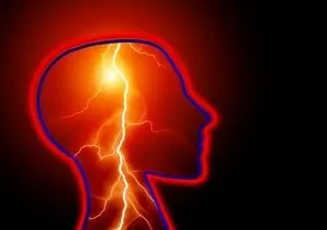 Pérdida de memoria por epilepsia